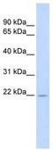 TNF Superfamily Member 18 antibody, TA338996, Origene, Western Blot image 