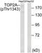 DNA Topoisomerase II Alpha antibody, 79-874, ProSci, Western Blot image 