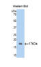 Tryptase Gamma 1 antibody, LS-C299233, Lifespan Biosciences, Western Blot image 