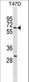 ABS antibody, LS-C157682, Lifespan Biosciences, Western Blot image 