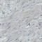 Endoglin antibody, AMAb90925, Atlas Antibodies, Immunohistochemistry frozen image 