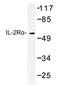 CD25 antibody, AP20309PU-N, Origene, Western Blot image 
