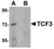 Transcription Factor 3 antibody, TA306926, Origene, Western Blot image 