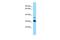 Lysophospholipase Like 1 antibody, PA5-45807, Invitrogen Antibodies, Western Blot image 