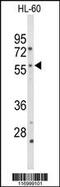 Cytochrome P450 Family 2 Subfamily C Member 19 antibody, 62-417, ProSci, Western Blot image 