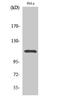 Signal Transducer And Activator Of Transcription 2 antibody, A01360Y690, Boster Biological Technology, Western Blot image 