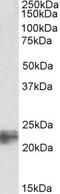 Transgelin antibody, PA5-18252, Invitrogen Antibodies, Western Blot image 