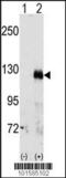 EPH Receptor A3 antibody, 63-041, ProSci, Western Blot image 