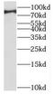 Pogo Transposable Element Derived With KRAB Domain antibody, FNab06604, FineTest, Western Blot image 