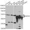 Mitogen-Activated Protein Kinase 8 antibody, A2462, ABclonal Technology, Western Blot image 