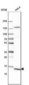 Cancer/Testis Antigen 83 antibody, NBP1-84343, Novus Biologicals, Western Blot image 