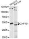 Zinc Finger Protein 101 antibody, LS-C749359, Lifespan Biosciences, Western Blot image 