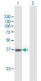 Solute Carrier Family 22 Member 18 antibody, H00005002-B01P, Novus Biologicals, Western Blot image 