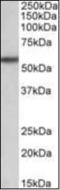 Transforming Growth Factor Beta Receptor 1 antibody, orb375355, Biorbyt, Western Blot image 