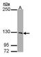 Phosphorylase Kinase Regulatory Subunit Alpha 1 antibody, PA5-22024, Invitrogen Antibodies, Western Blot image 