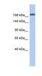 Leucine Rich Repeat Containing 37 Member A3 antibody, NBP1-91474, Novus Biologicals, Western Blot image 