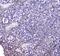 TNF Receptor Superfamily Member 17 antibody, PA5-80150, Invitrogen Antibodies, Immunohistochemistry paraffin image 