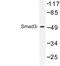 SMAD Family Member 3 antibody, LS-C177435, Lifespan Biosciences, Western Blot image 