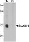 SLAIN Motif Family Member 1 antibody, orb75722, Biorbyt, Western Blot image 
