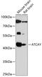 ATCAY Kinesin Light Chain Interacting Caytaxin antibody, 15-800, ProSci, Western Blot image 