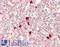 Fc Receptor Like 5 antibody, LS-B14029, Lifespan Biosciences, Immunohistochemistry paraffin image 