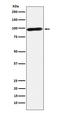 Calmegin antibody, M05261, Boster Biological Technology, Western Blot image 