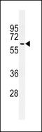 Autophagy Related 14 antibody, LS-C156739, Lifespan Biosciences, Western Blot image 