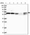 Tigger Transposable Element Derived 1 antibody, NBP2-47606, Novus Biologicals, Western Blot image 