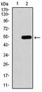 Transient Receptor Potential Cation Channel Subfamily C Member 6 antibody, orb76267, Biorbyt, Western Blot image 