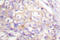 FAS antibody, LS-C176337, Lifespan Biosciences, Immunohistochemistry paraffin image 
