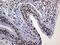 Ring Finger Protein 1 antibody, M01824, Boster Biological Technology, Immunohistochemistry paraffin image 