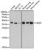 Caspase 6 antibody, A12991, ABclonal Technology, Western Blot image 