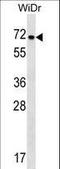 NADPH Oxidase 1 antibody, LS-C158413, Lifespan Biosciences, Western Blot image 