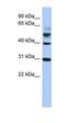 Tubulin Tyrosine Ligase antibody, orb325834, Biorbyt, Western Blot image 