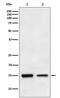 Transforming Growth Factor Alpha antibody, M01779-1, Boster Biological Technology, Western Blot image 