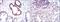 Nuclear Factor Kappa B Subunit 1 antibody, MA5-15860, Invitrogen Antibodies, Immunohistochemistry paraffin image 