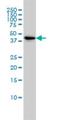 TSC22 Domain Family Member 4 antibody, H00081628-M06, Novus Biologicals, Western Blot image 