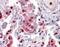 S100 Calcium Binding Protein A9 antibody, NBP1-18843, Novus Biologicals, Immunohistochemistry paraffin image 