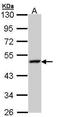 Lysosomal Associated Membrane Protein 3 antibody, GTX112715, GeneTex, Western Blot image 