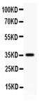 FAS antibody, PA5-79237, Invitrogen Antibodies, Western Blot image 