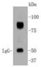 Aryl Hydrocarbon Receptor Nuclear Translocator antibody, A02263, Boster Biological Technology, Western Blot image 