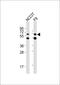 G Protein Nucleolar 3 antibody, MBS9203957, MyBioSource, Western Blot image 