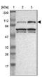 DEAD-Box Helicase 20 antibody, PA5-52157, Invitrogen Antibodies, Western Blot image 