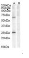 Collagen Type IV Alpha 3 Binding Protein antibody, NB100-93386, Novus Biologicals, Western Blot image 