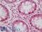 Tubulin Folding Cofactor C antibody, LS-C317325, Lifespan Biosciences, Immunohistochemistry paraffin image 