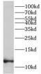 Late Cornified Envelope 1B antibody, FNab04724, FineTest, Western Blot image 