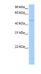 RNA Binding Motif Protein 45 antibody, GTX47202, GeneTex, Western Blot image 