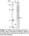 AKT Serine/Threonine Kinase 2 antibody, LS-C47177, Lifespan Biosciences, Western Blot image 