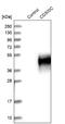 CMRF35-like molecule 6 antibody, NBP1-84432, Novus Biologicals, Western Blot image 