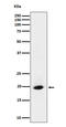 Signal Recognition Particle 19 antibody, M07666, Boster Biological Technology, Western Blot image 